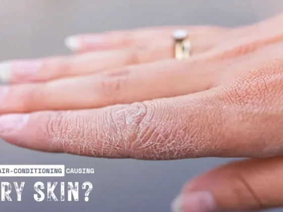 Does AC Dry Out Your Skin? How to Protect Your Skin from Air Conditioning in the UAE