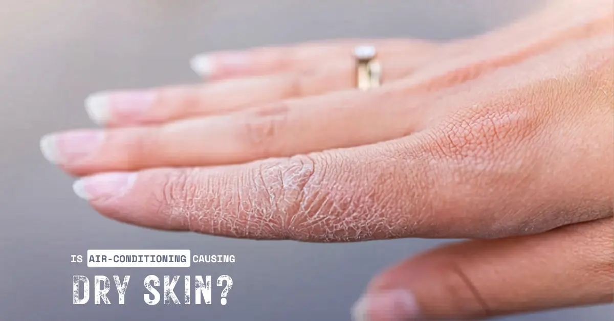 Is air conditioning causing dry skin