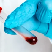 Growing Popularity of At-Home Blood Testing in Dubai