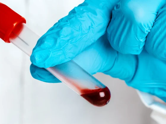 The Growing Popularity of At-Home Blood Testing in Dubai: Trends to Watch