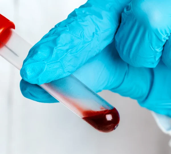 Growing Popularity of At-Home Blood Testing in Dubai