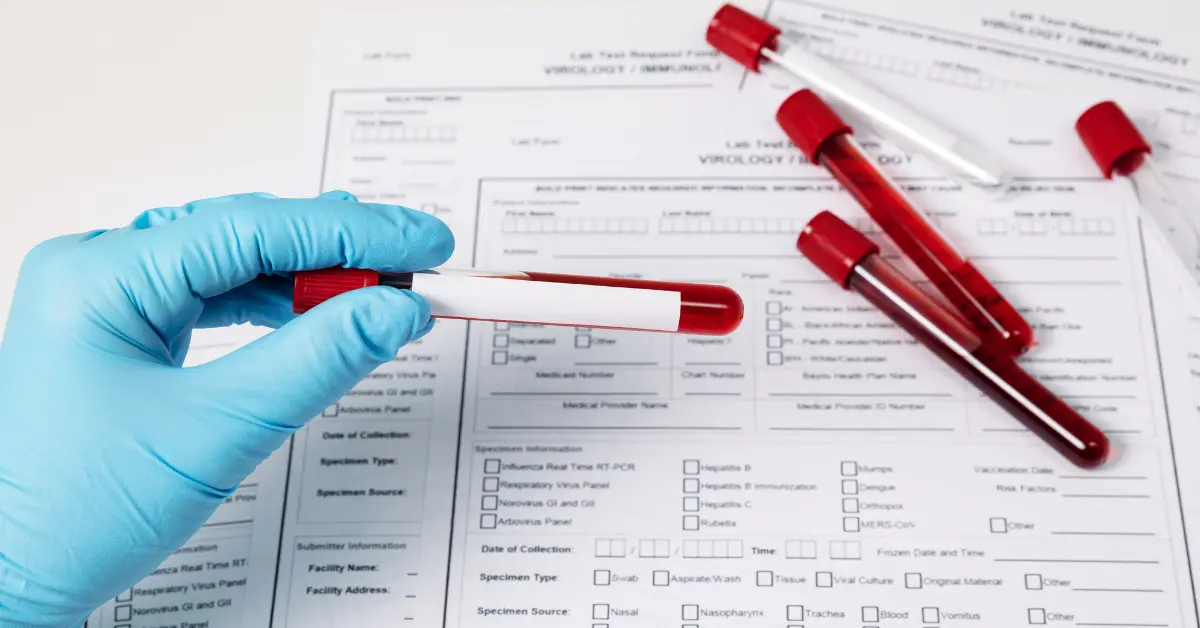 A sample collected by a registered nurse from lab test at home in Dubai