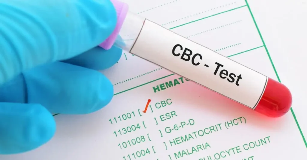 What Is a CBC Test?