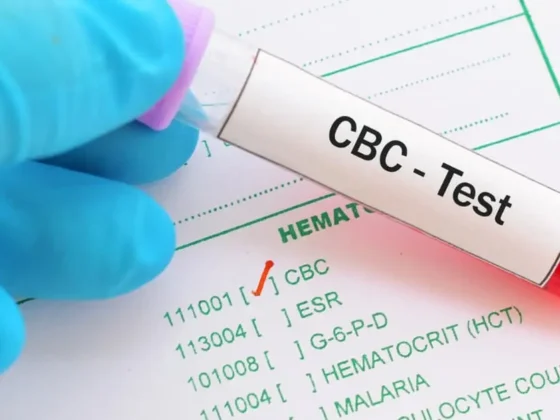 What Is a CBC Test? Everything You Need to Know