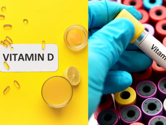 Common Signs of Vitamin D Deficiency: Is It Time for a Vitamin D Test at Home?