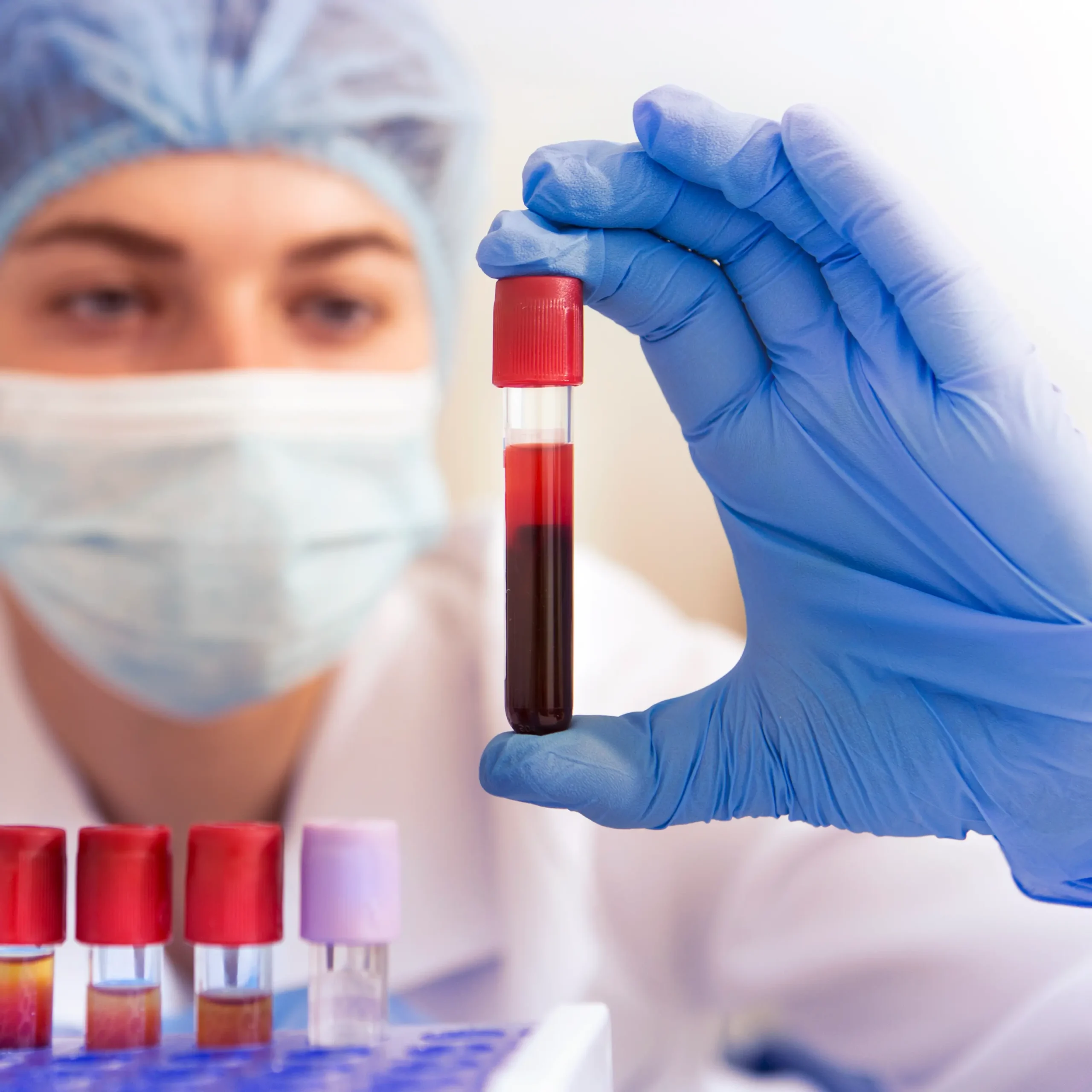 woman-lab-worker-holding-test-tube-doing-blood-ana-2025-03-18-17-26-54-utc