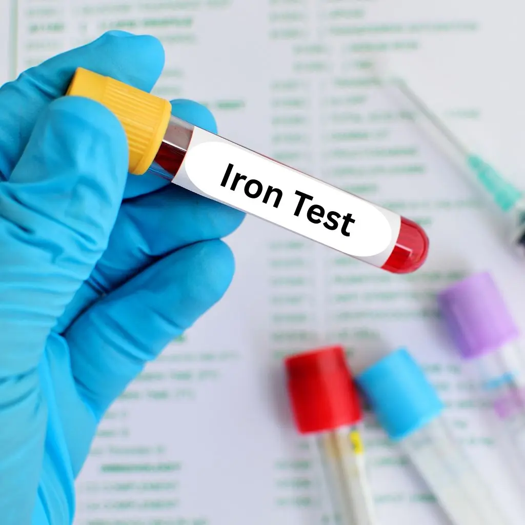 Iron Test at Home in Dubai