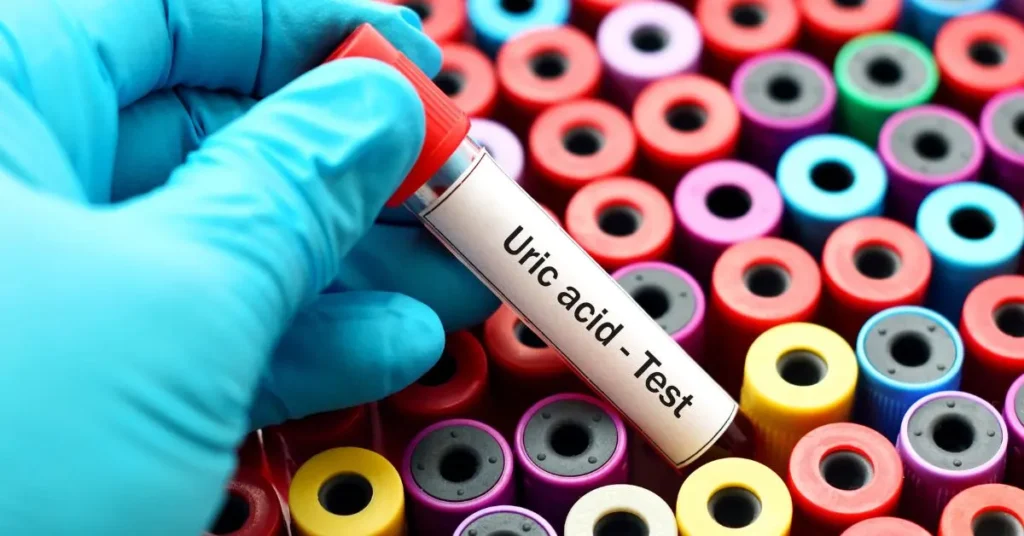 Why You Should Get a Uric Acid Test in Dubai: Symptoms, Risks, and Prevention