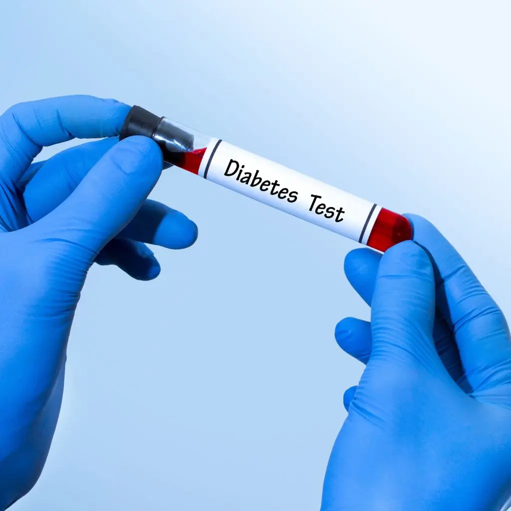 Diabetic profile test at home in Dubai