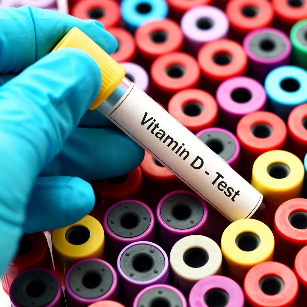 Vitamin D test at home in Dubai