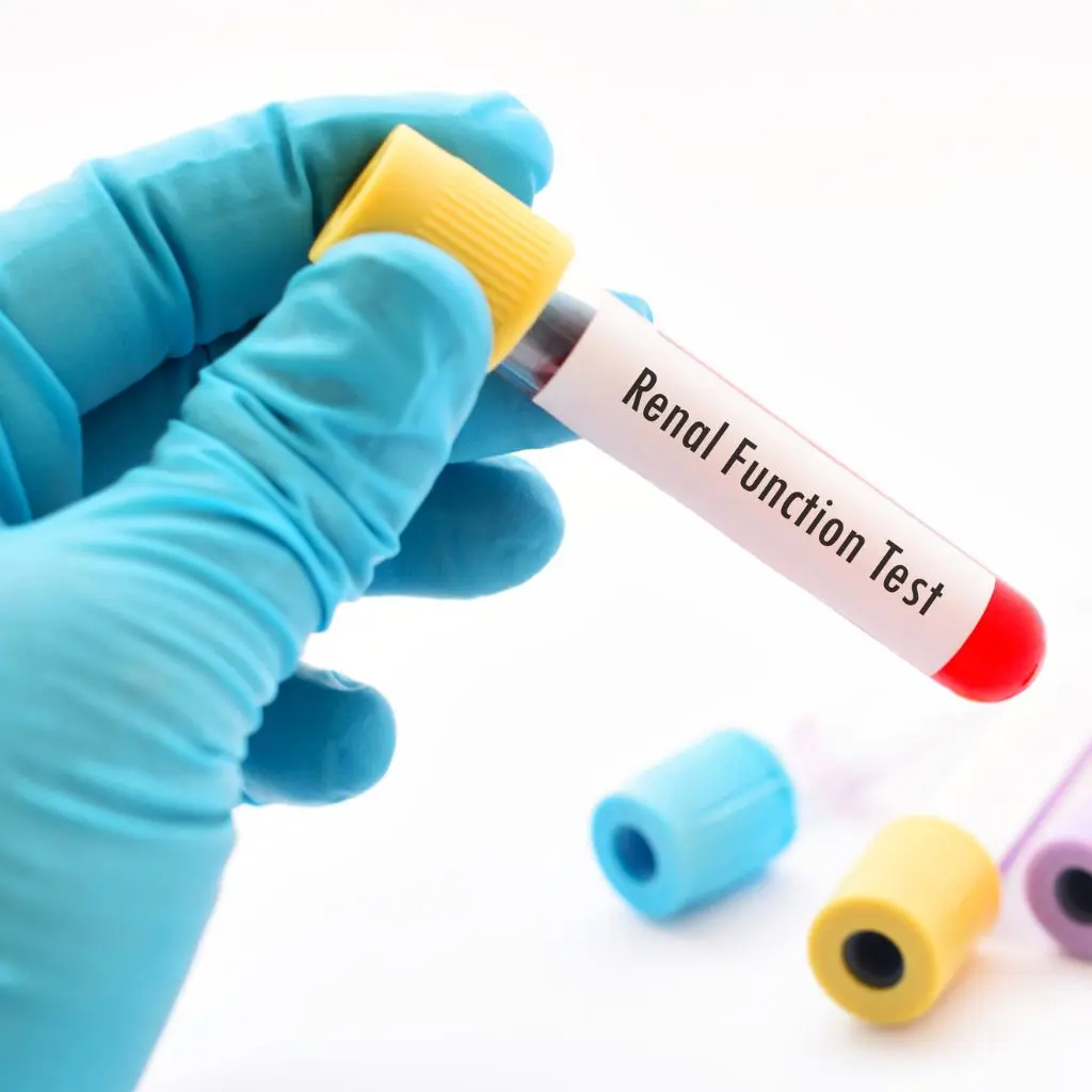 Kidney Function test at Home in Dubai