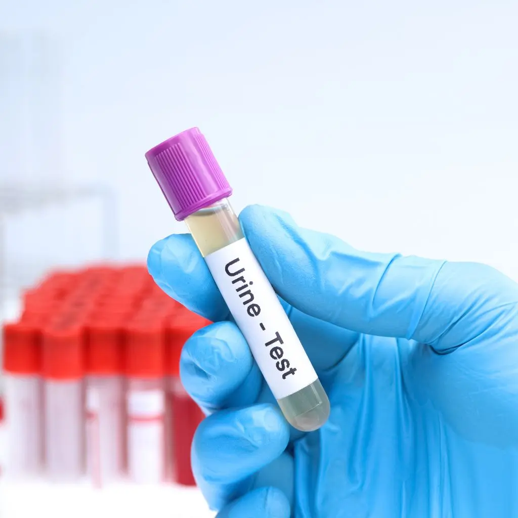 urine analysis test at home in Dubai
