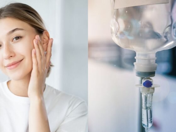 Best Time to Start Skin Glow IV Therapy Before Events or Weddings in Dubai