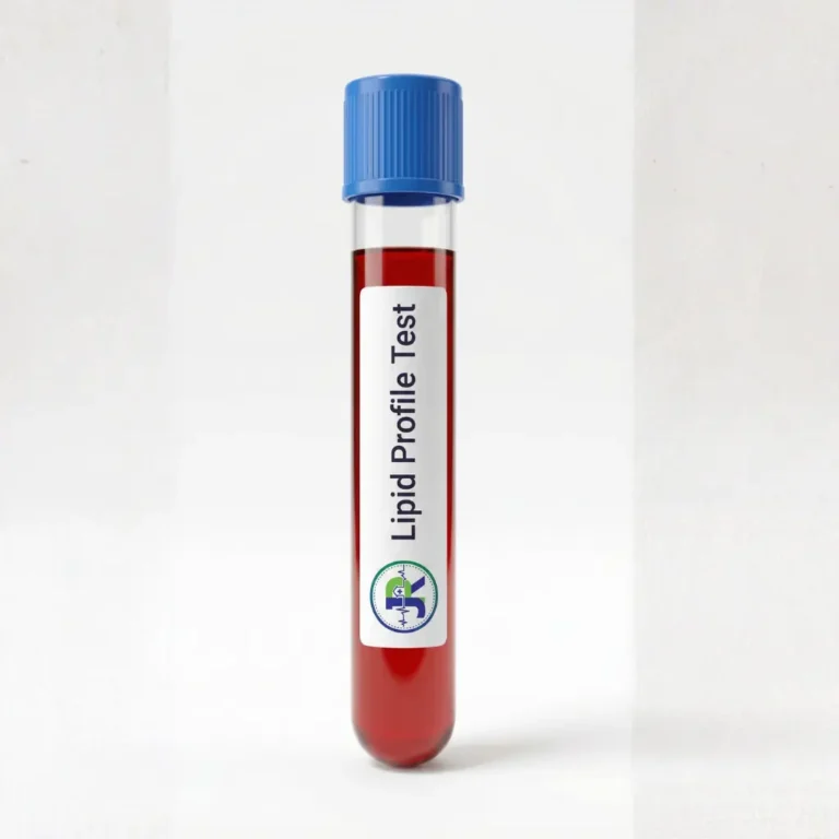 Lipid Profile Test in Dubai