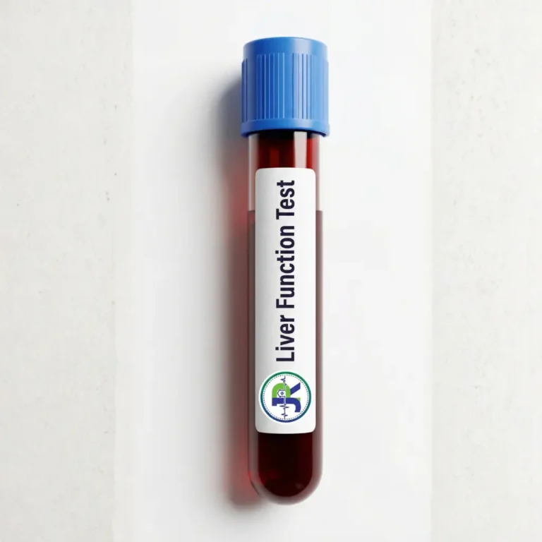 Liver Function Test in Dubai