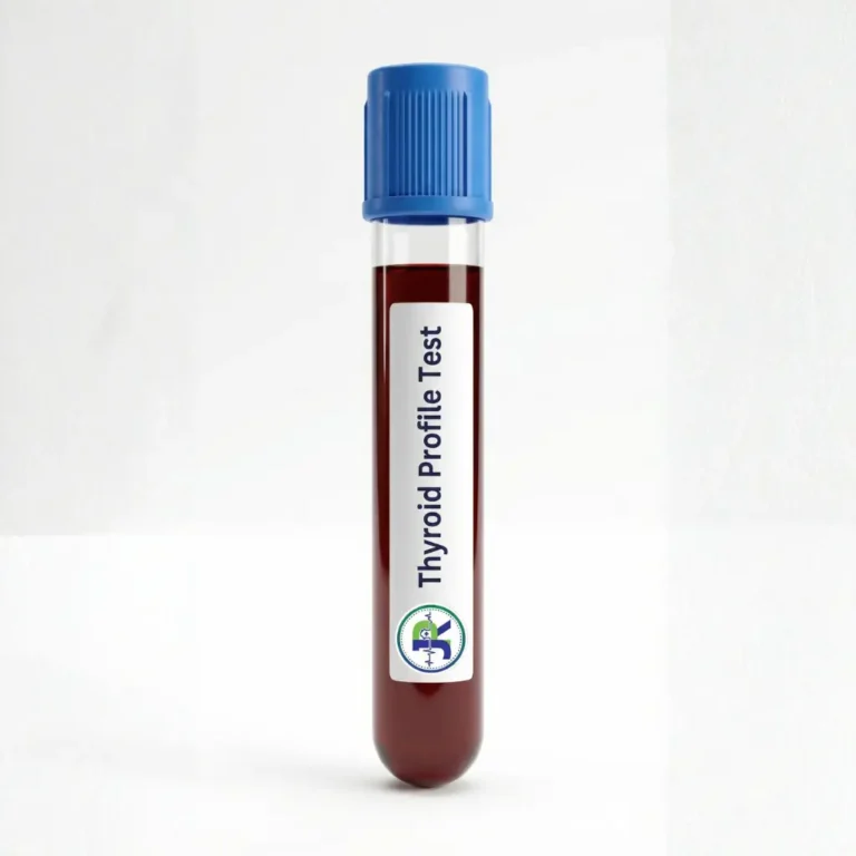 Thyroid Profile Test in Dubai