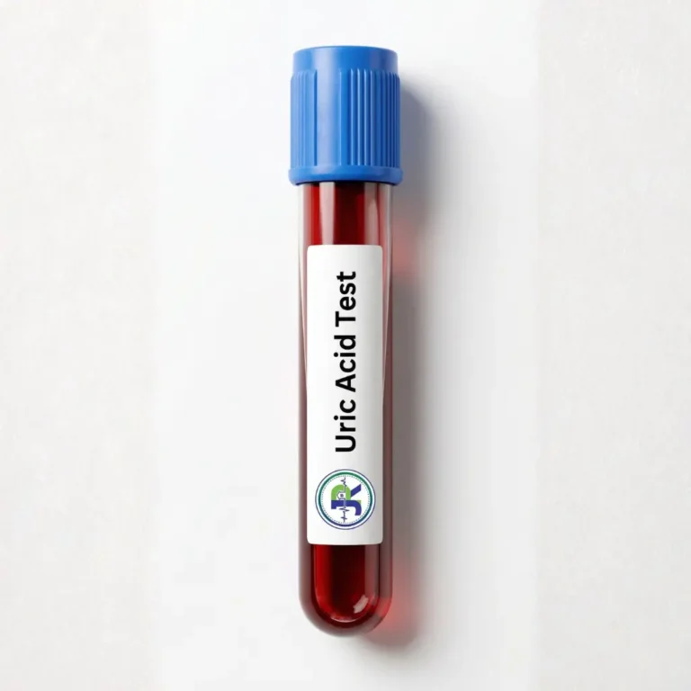 Uric Acid Test in Dubai