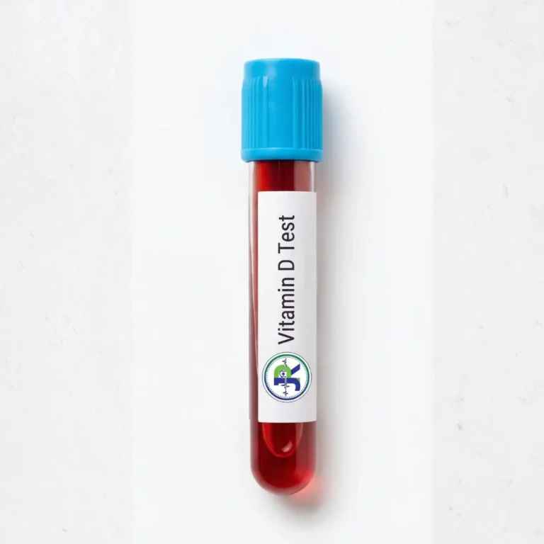 Vitamin D test in Dubai