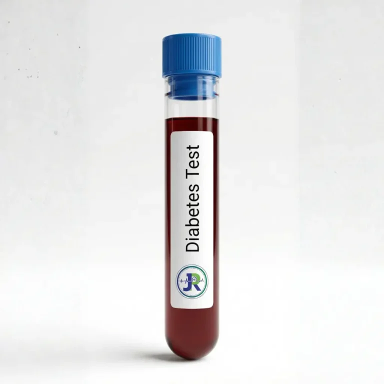 Diabetes profile test in Dubai