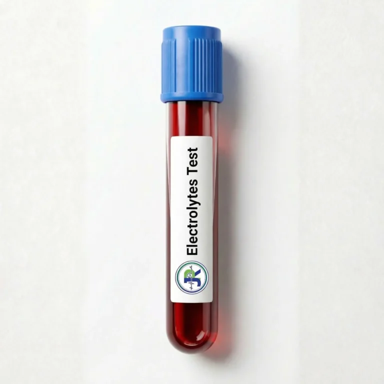 Electrolyte Test at home in Dubai