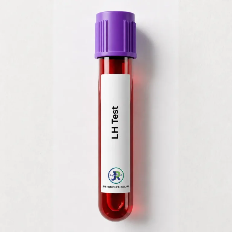 LH (Luteinizing Hormone) blood test at home in Dubai