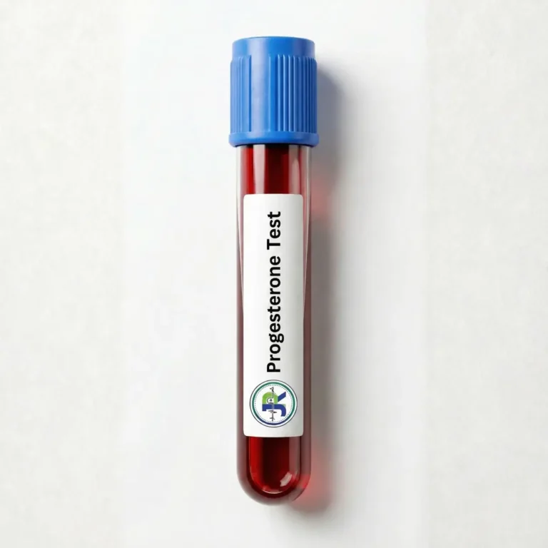 Progesterone Blood test at home in Dubai