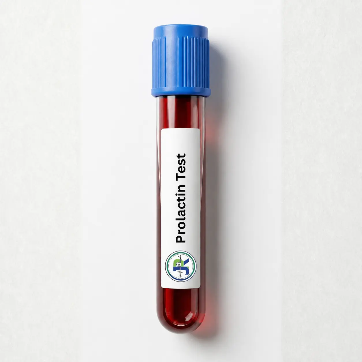 Prolactin Test at home in Dubai