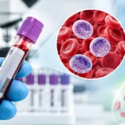 Reticulocyte count blood test for red blood cell production