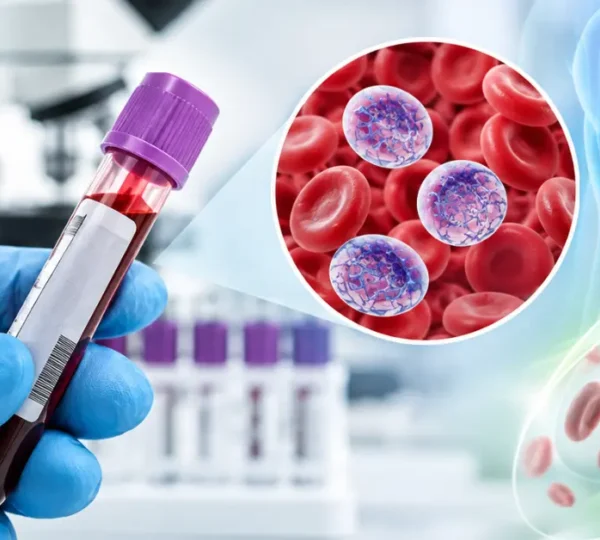 Reticulocyte count blood test for red blood cell production